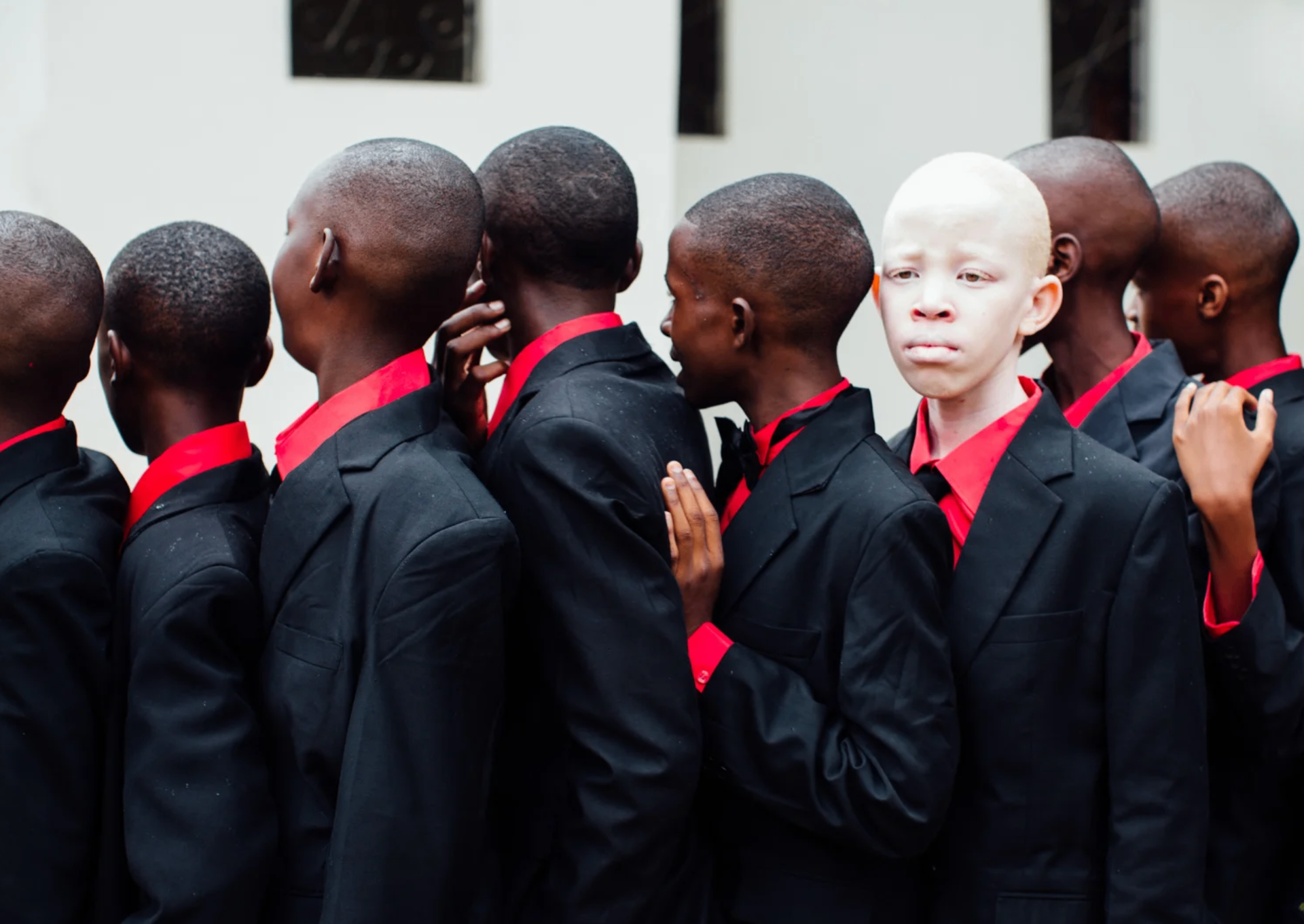 Line of Tanzanian schoolboys with one child with albinism